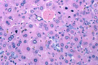 Peroxisome Proliferation