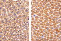 Peroxisome Proliferation