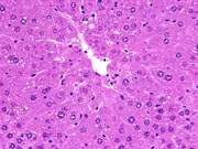 large areas of fatty change liver