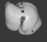 Parietal Liver Gross