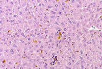 Pigmented Kupffer Cell