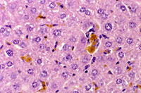 Pigmented Kupffer Cell