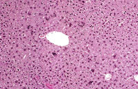 Multinucleated Hepatocytes