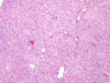 localized area of hepatocytes