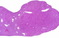 Alb-uPA Transgenic Mouse Liver Lesions