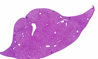 Alb-uPA Transgenic Mouse Liver Lesions