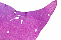 Alb-uPA Transgenic Mouse Liver Lesions