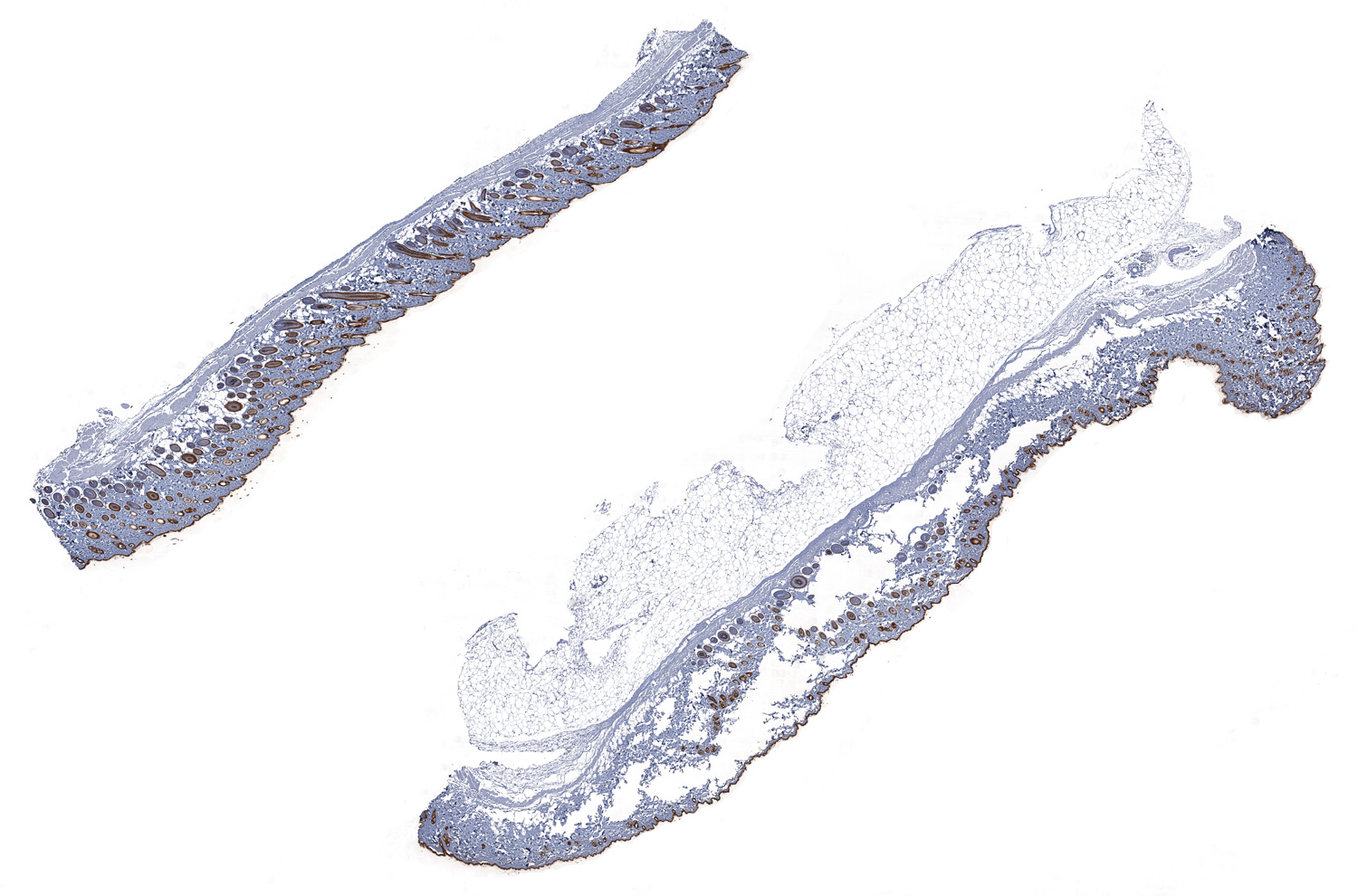 Cytokeratin Wide Spectrum