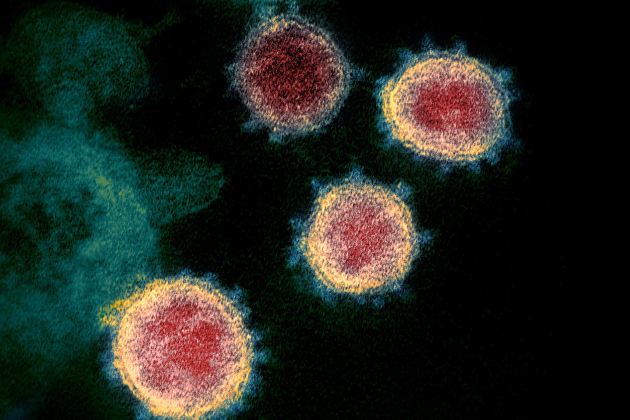 SARS-CoV-2 virus particles emerging from cells