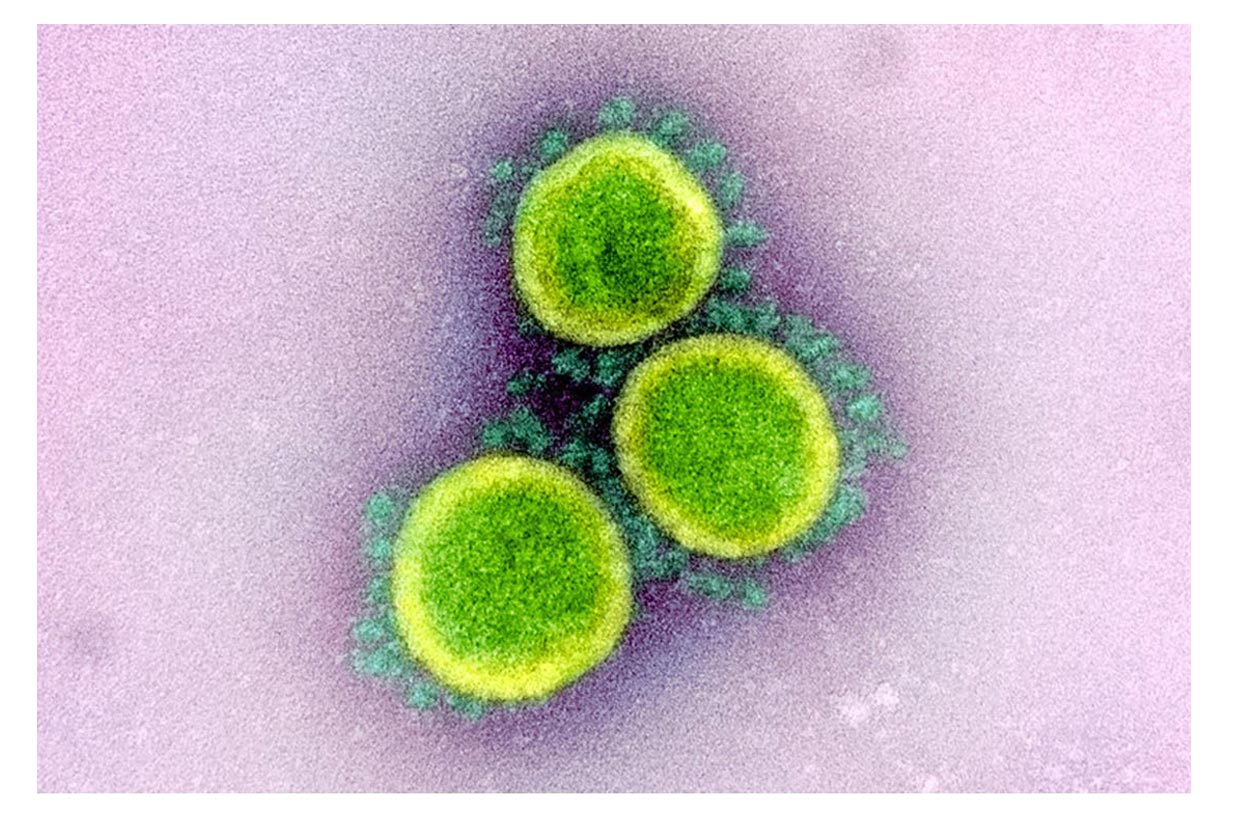 close up of coronas of coronaviruses from a transmission electron micrograph of virus particles