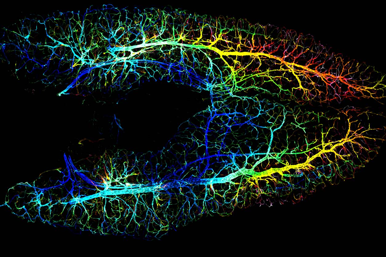zebrafish ovary showing toxicant exposure
